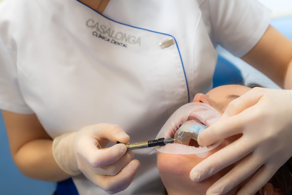 Composite inyectable dentistas en Teo
