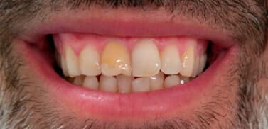 Estética dental antes de la intervención